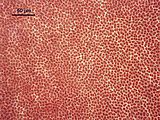 6 - Cellule corticali in visione superficiale